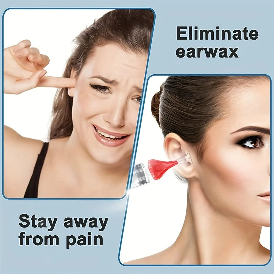 Ear Wax Removal Rinse Syringe Kit With Soft Nozzles